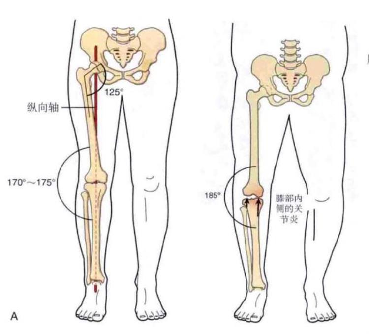 詹姆斯也是O型腿为什么他膝关节不疼而我打篮球就腿痛呢