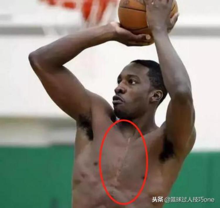 皮尔斯被刺11刀原因「NBA5大差点丢命的事件皮尔斯身中11刀有人遭枪击因认错人」