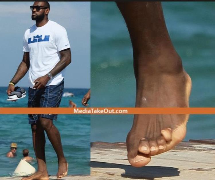 NBA球星真是透支健康赚钱詹皇脚趾似外星人科比手指变形