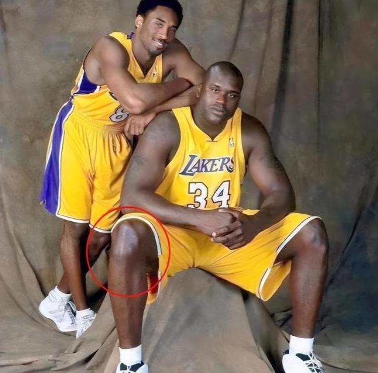 奥尼尔的膝盖构造「NBA百年一遇的天赋奥尼尔的膝盖詹姆斯的脚踝字母的跟腱」