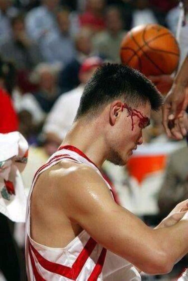篮球过分挥肘定义「什么是NBA级别的对抗挥肘让姚明出血詹皇直接把球扣变形」