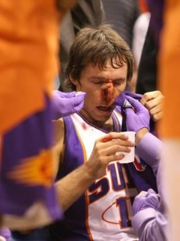 NBA如战场这些照片看出残酷一面姚明血流满面威少脸部变形
