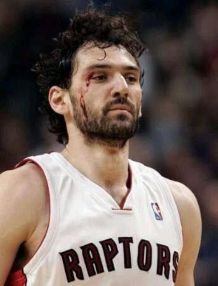 8图看NBA硬汉流血瞬间詹姆斯眼睛出血科比脸遭划伤一脸淡定