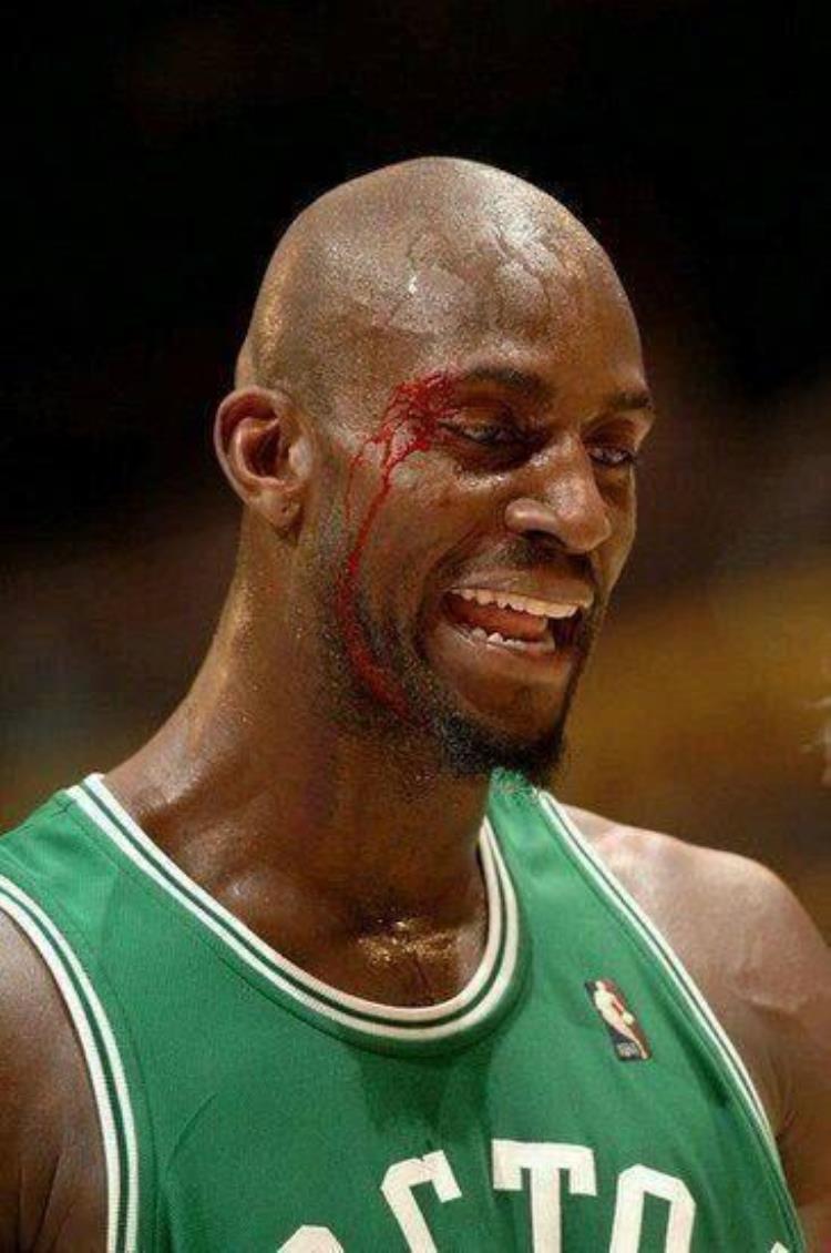 8图看NBA硬汉流血瞬间詹姆斯眼睛出血科比脸遭划伤一脸淡定