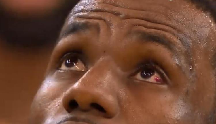 詹姆斯总决赛被伤眼睛「10图看NBA揪心的瞬间詹皇眼睛出血乔治脚踝弯曲90度」