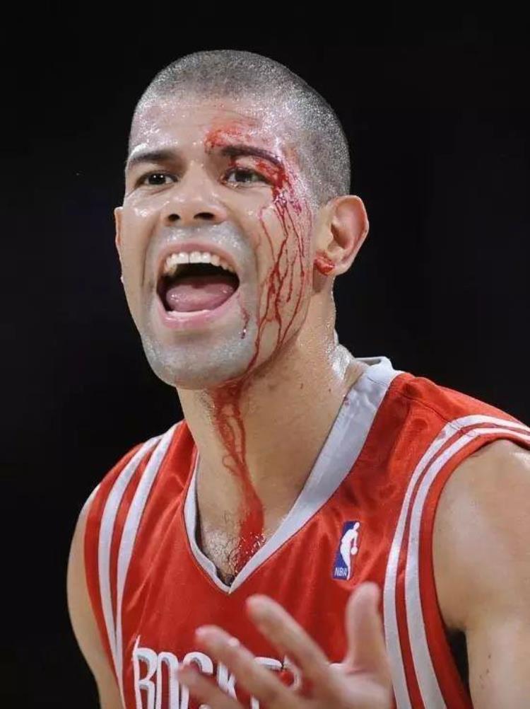 nba球员抽筋「NBA赛场上10大硬汉流感抽筋不算啥最后1人光止血就用20块纱布」