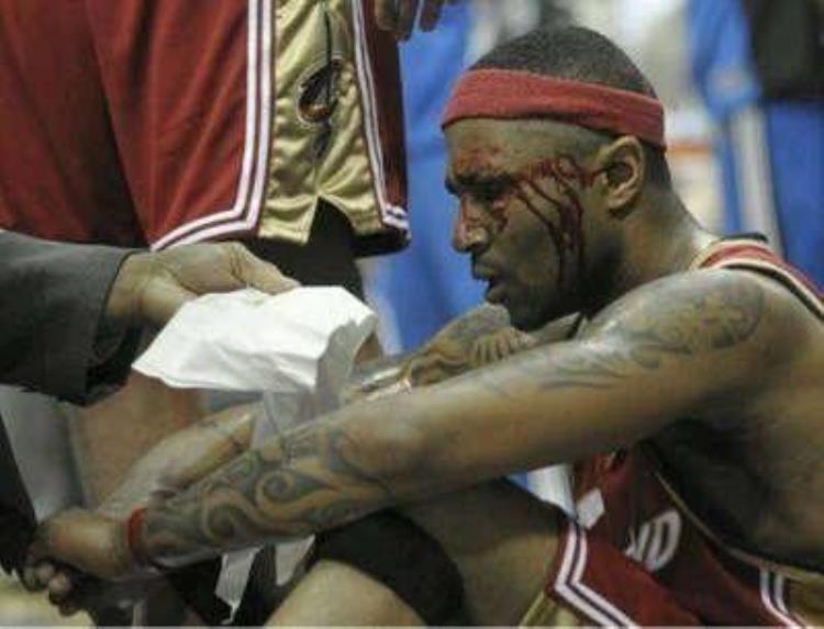 nba球员流血「爱篮球爱到死盘点NBA赛场上的那些流血镜头」