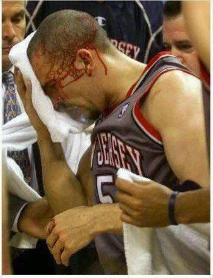 nba球员流血「爱篮球爱到死盘点NBA赛场上的那些流血镜头」