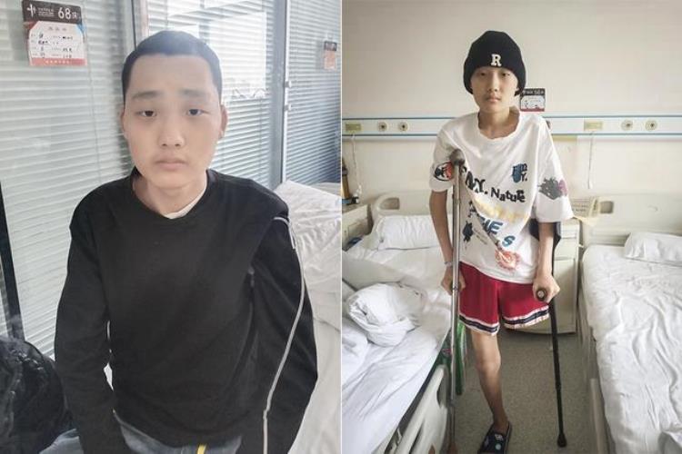 14岁男孩打篮球意外截瘫「18岁男孩打篮球不慎摔倒竟然查出骨癌刮骨疗伤后仍惨遭截肢」