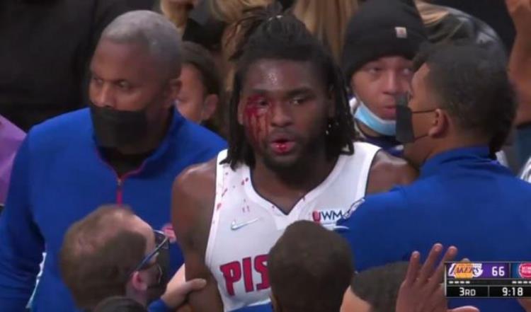 nba十大恶汉排行榜「NBA赛季10大恶犯詹皇把斯图尔特打满脸血排第一KD约老师上榜」