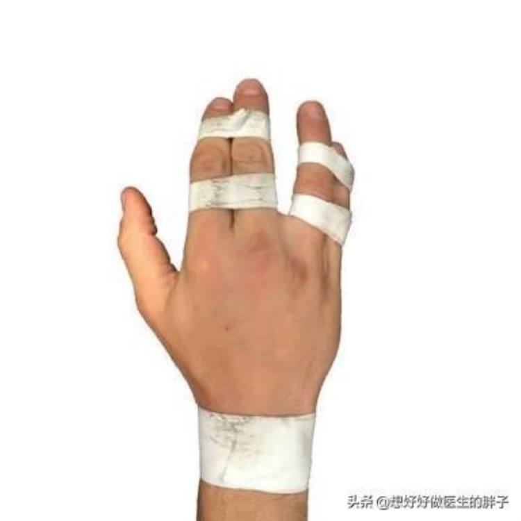 手指打篮球受伤了,一个月都没好怎么回事「手指打篮球挫伤了半年不恢复还肿着听听医生给您的治疗建议」