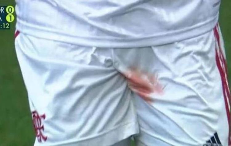 巴西联赛出现让所有男人做噩梦的一幕球员球裤都被染红了