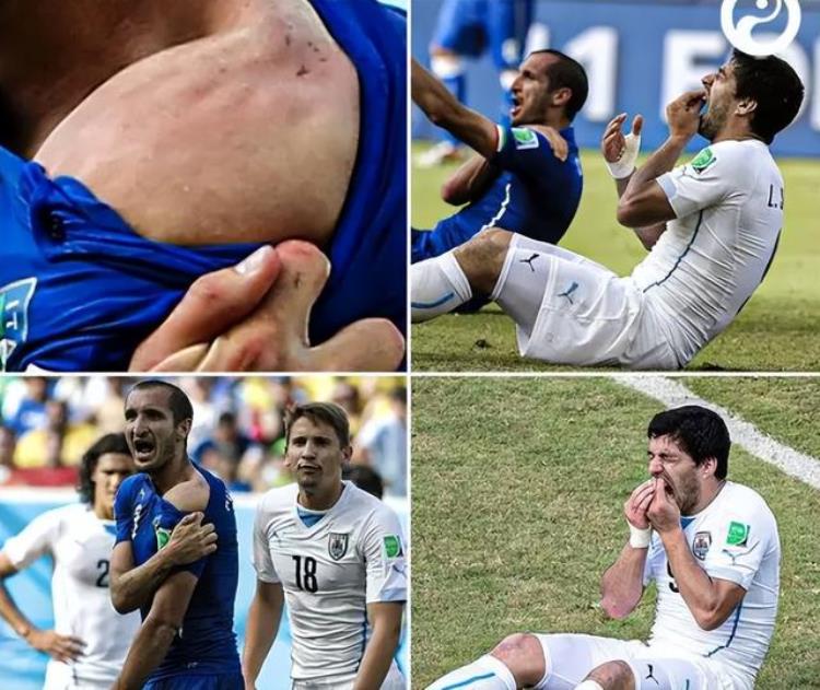 世界杯和足球牙医从不缺席