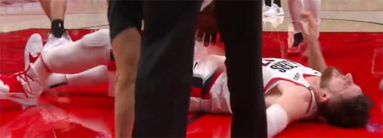 NBA篮球赛场某球星小腿骨折严重变形确诊胫腓骨骨折