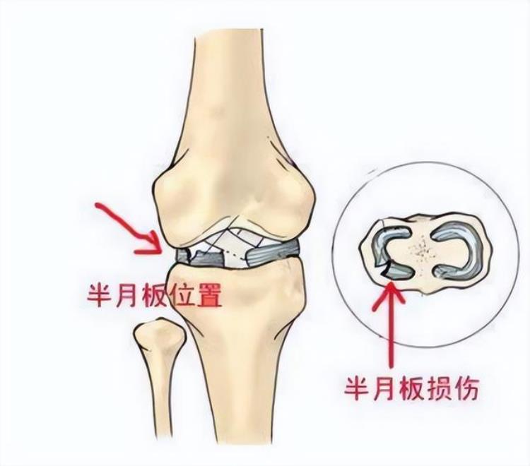 这些球员身体上有缺陷韦德进NBA前摘除半月板姚明左耳失聪