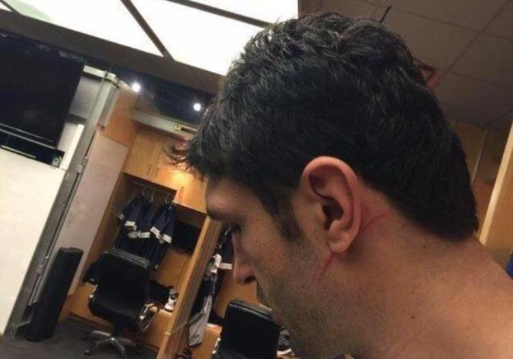 篮球过分挥肘定义「什么是NBA级别的对抗挥肘让姚明出血詹皇直接把球扣变形」