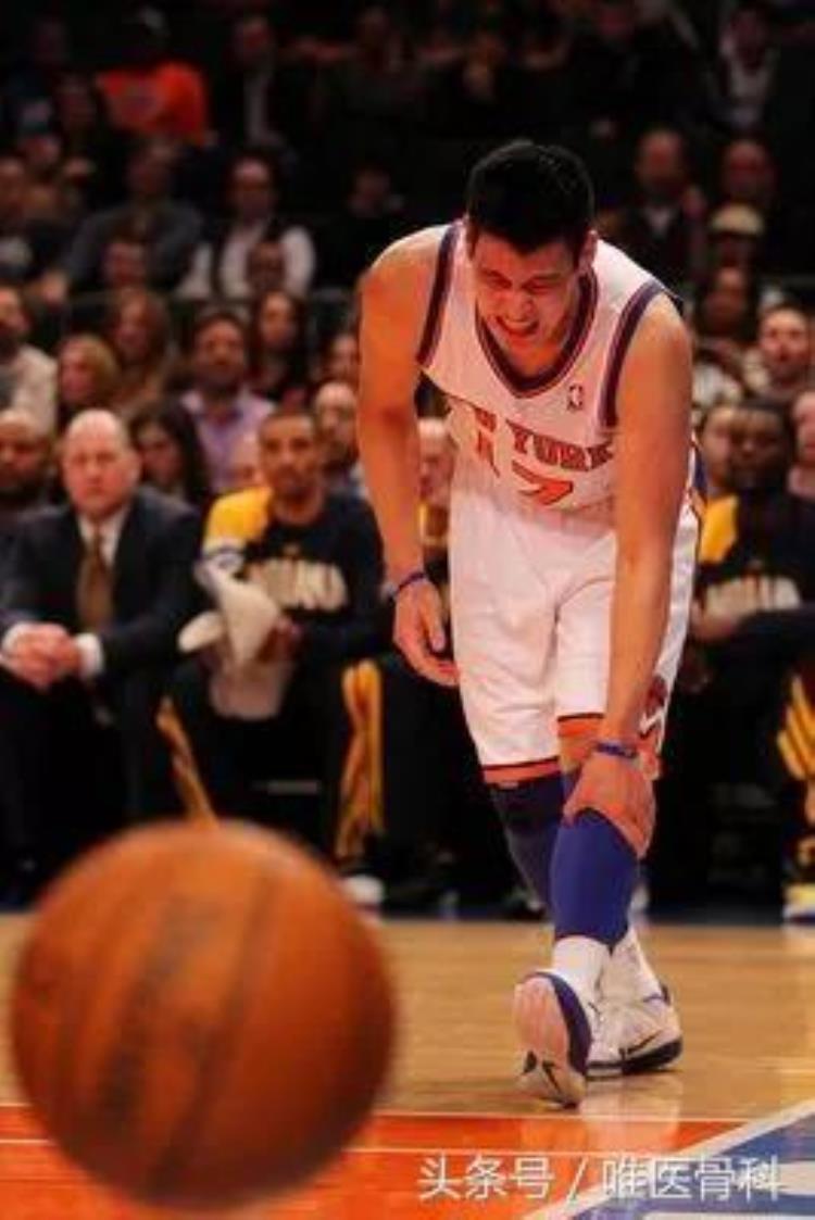 半月板损伤nba球星「半月板的伤痛让NBA球星备受折磨骨科医生揭开治疗真相」