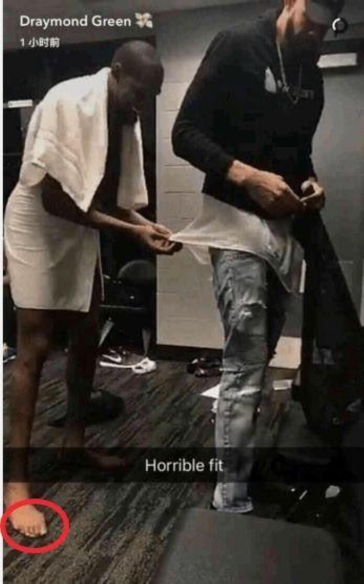 为什么nba球员的脚趾会变形「NBA球员脚趾为何这么多畸形他们突破时球鞋都快撑破了」