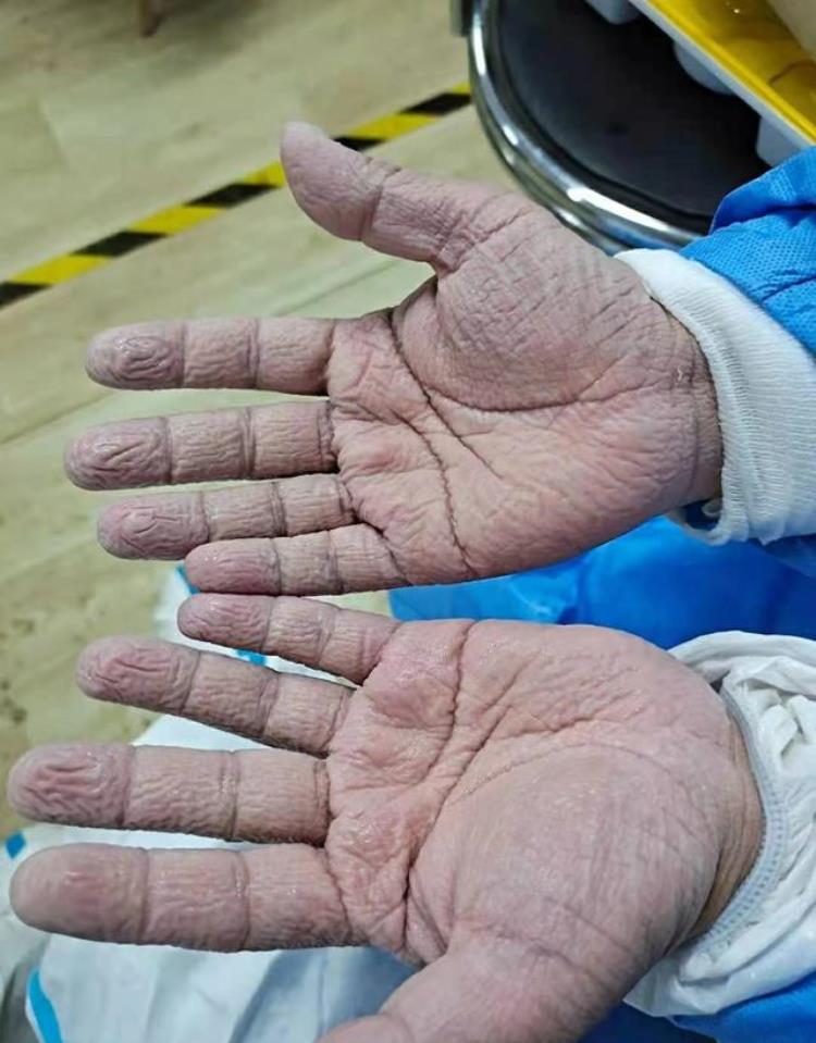 有没有第三针加强针针对德尔塔病毒,德尔塔需要打加强针吗