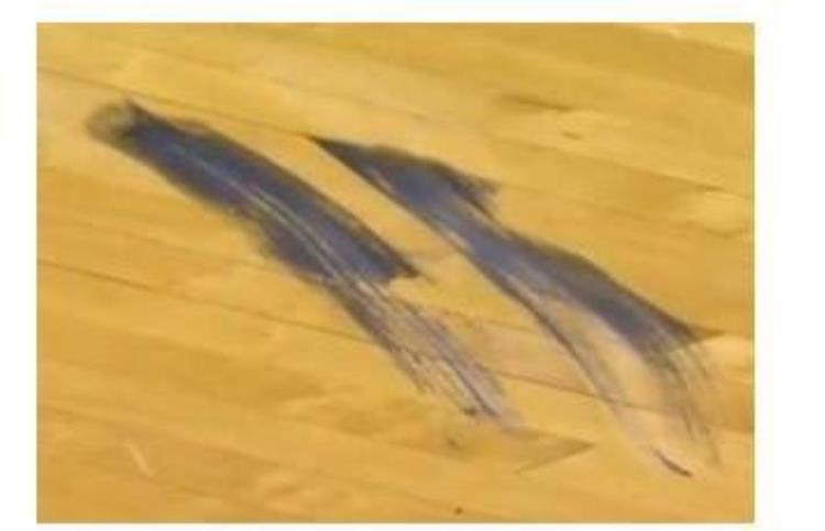 为什么nba球员的脚趾会变形「NBA球员脚趾为何这么多畸形他们突破时球鞋都快撑破了」