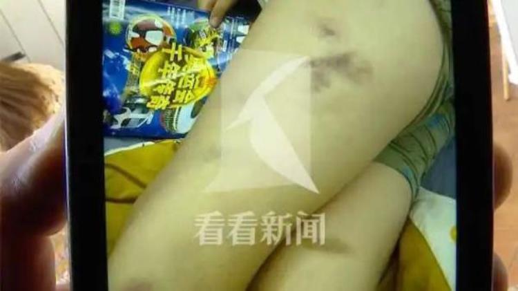 上海一9岁男孩练击剑遭教练抽打满身淤青教练仅被停课馆方辞退不了