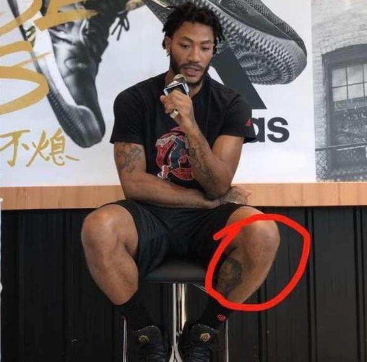 罗斯膝盖怎么了「10图看NBA球星有多不容易罗斯膝盖遍布伤痕詹姆斯脚趾已变形」