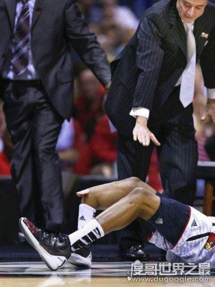保罗乔治哪场比赛断腿「保罗乔治断腿是哪一年2014年(NBA史上最恐怖的3次断腿事故)」