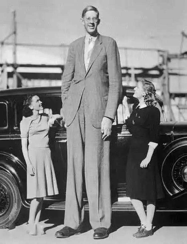 盘点全球最高的十个人身高的背后是常人难以想象的病痛折磨