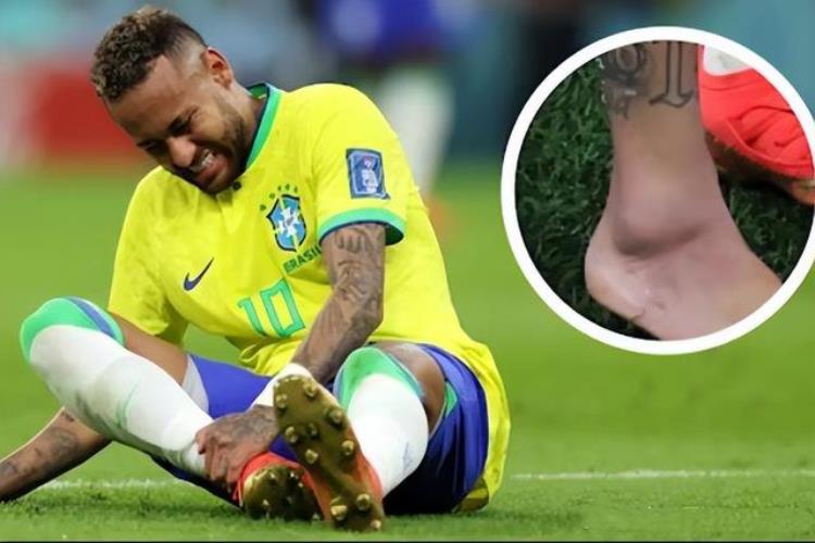 比赛中脚踝扭伤怎么办「世界杯赛场上脚踝扭伤怎么办别担心教你几个方法自己就能做到」